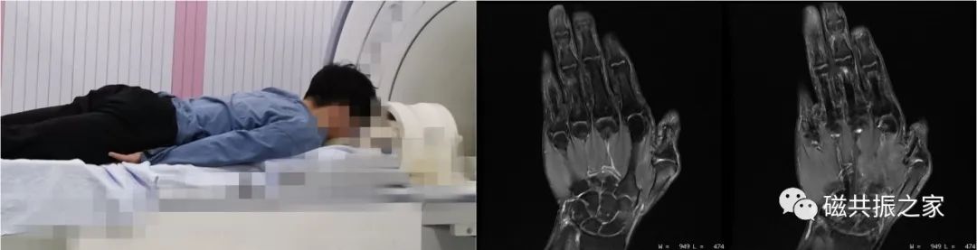 影像PPT - 那些简单又实用的MRI扫描体位-12 影像PPT - 那些简单又实用的MRI扫描体位-12