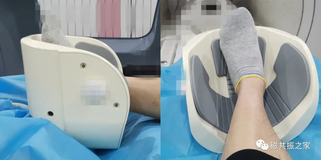 影像PPT - 那些简单又实用的MRI扫描体位-15 影像PPT - 那些简单又实用的MRI扫描体位-15