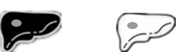 影像PPT - 肝胆特异性对比剂的成像要点-2
