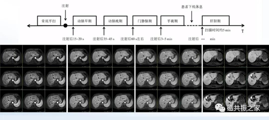 影像PPT - 肝胆特异性对比剂的成像要点-6 影像PPT - 肝胆特异性对比剂的成像要点-6