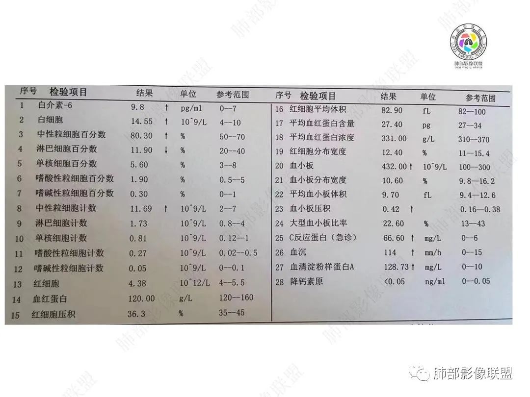 影像PPT - 【病例】右肺与肝脏病灶来袭,是否同源?-3 影像PPT - 【病例】右肺与肝脏病灶来袭,是否同源?-3