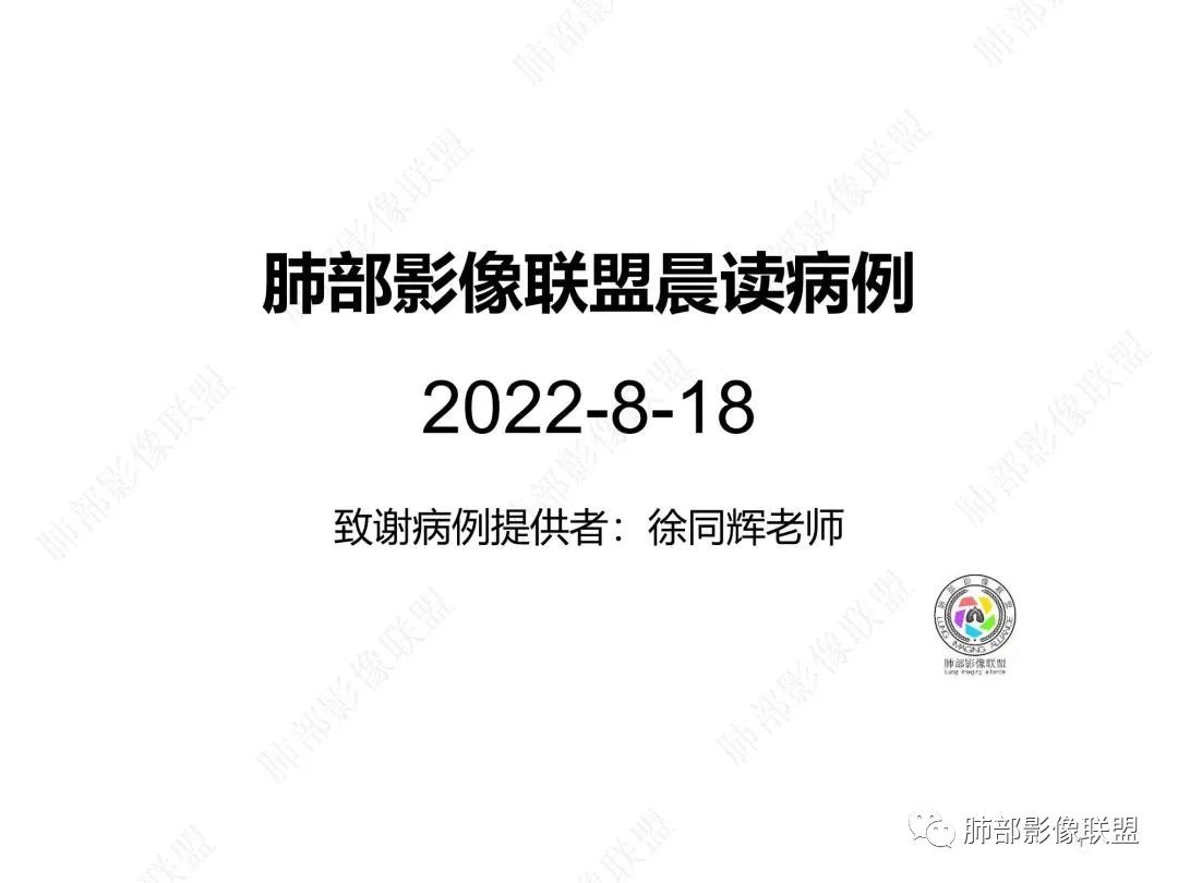影像PPT - 【病例】右肺与肝脏病灶来袭,是否同源?-1 影像PPT - 【病例】右肺与肝脏病灶来袭,是否同源?-1