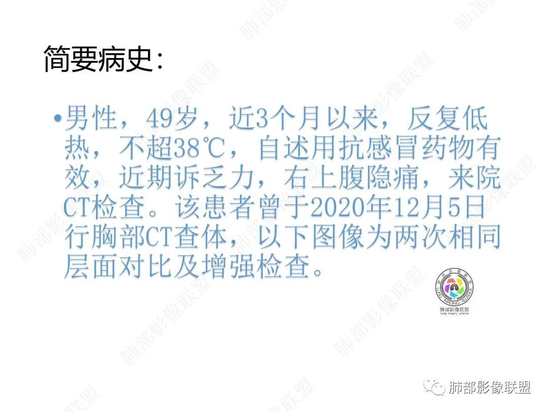 影像PPT - 【病例】右肺与肝脏病灶来袭,是否同源?-2 影像PPT - 【病例】右肺与肝脏病灶来袭,是否同源?-2