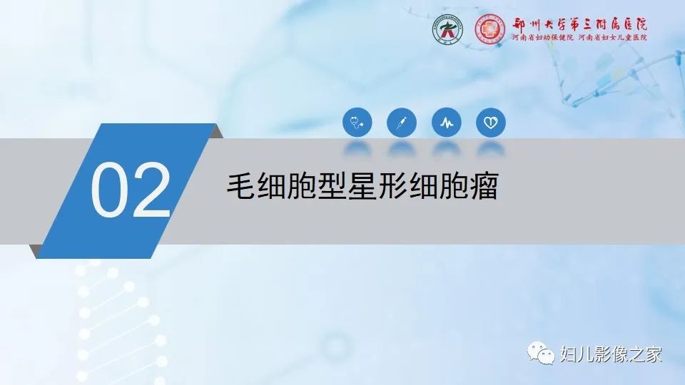 影像PPT - 【病例】毛细胞型星形细胞瘤1例CT及MR-12