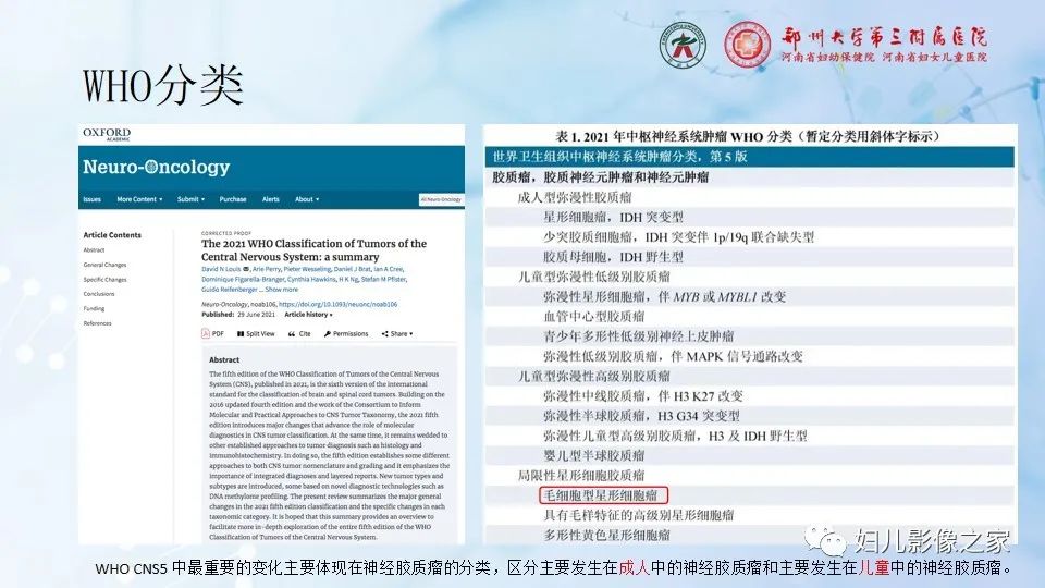 影像PPT - 【病例】毛细胞型星形细胞瘤1例CT及MR-14