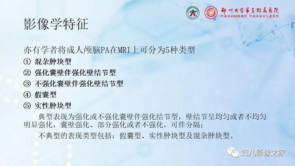 影像PPT - 【病例】毛细胞型星形细胞瘤1例CT及MR-19