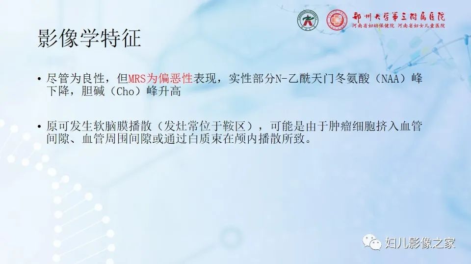 影像PPT - 【病例】毛细胞型星形细胞瘤1例CT及MR-20