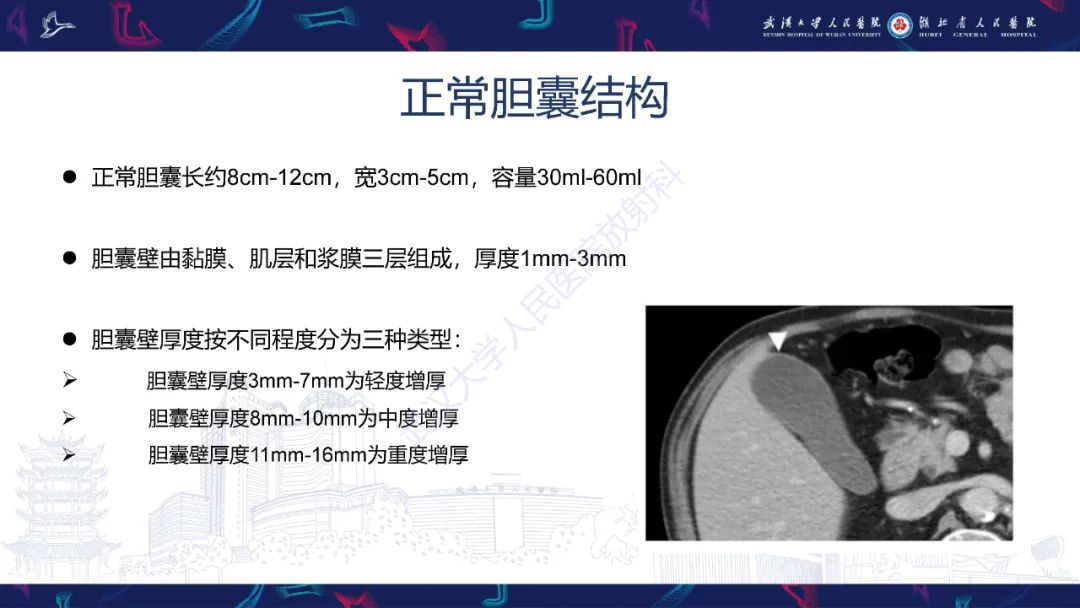 影像PPT - 【PPT】胆囊壁增厚影像鉴别诊断-2