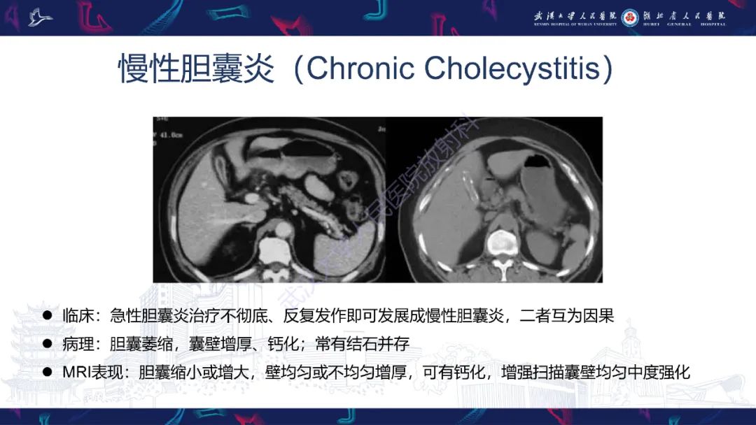 影像PPT - 【PPT】胆囊壁增厚影像鉴别诊断-8