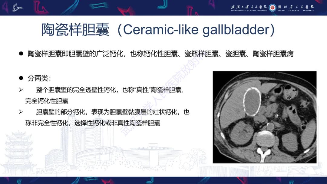 影像PPT - 【PPT】胆囊壁增厚影像鉴别诊断-9