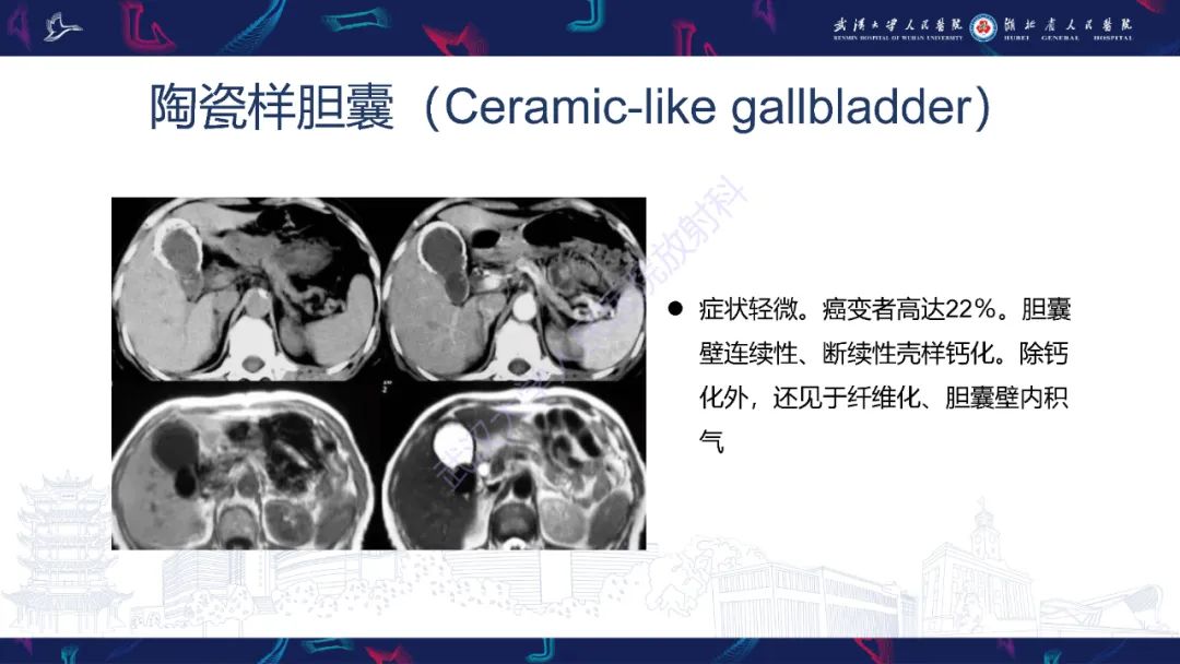 影像PPT - 【PPT】胆囊壁增厚影像鉴别诊断-10