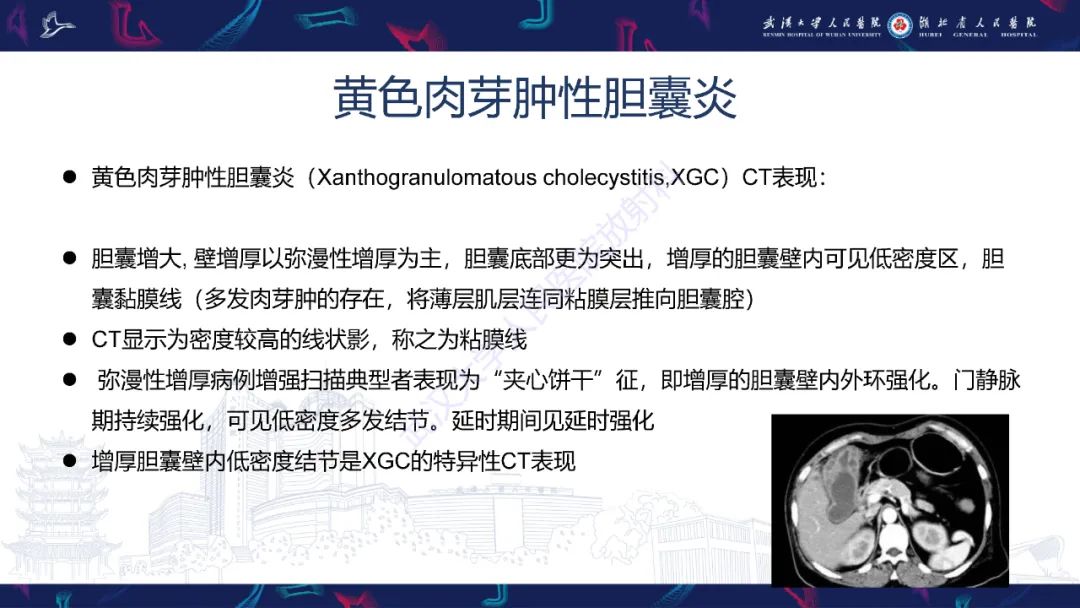 影像PPT - 【PPT】胆囊壁增厚影像鉴别诊断-12