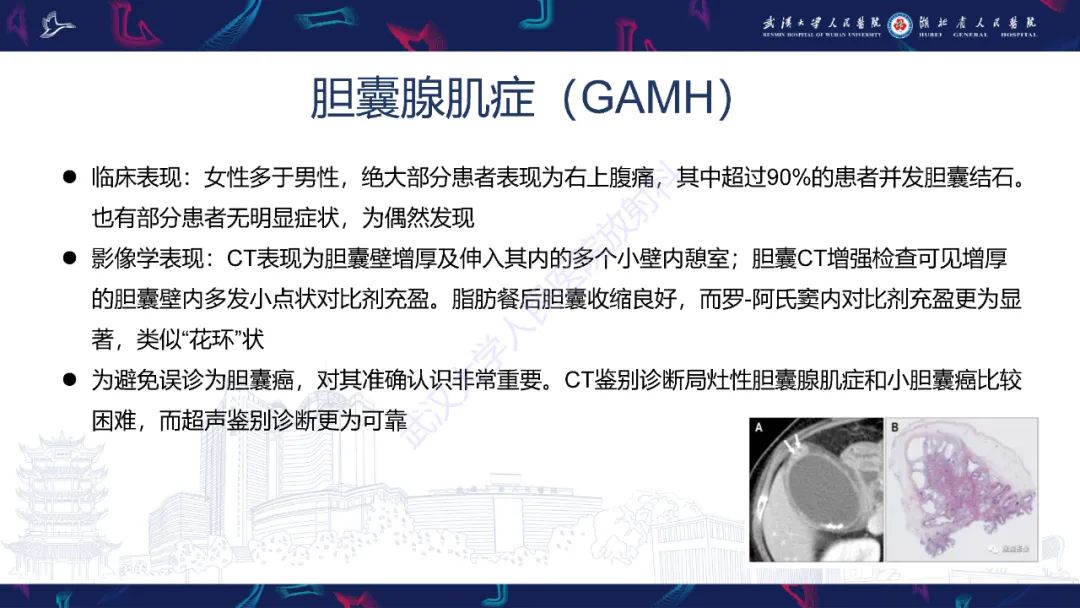 影像PPT - 【PPT】胆囊壁增厚影像鉴别诊断-16