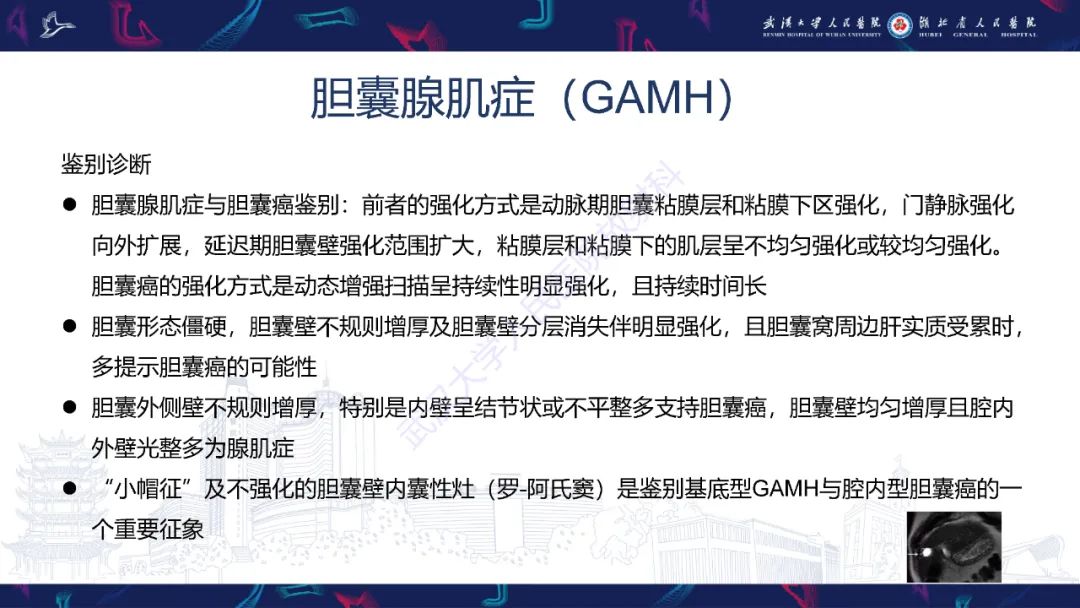 影像PPT - 【PPT】胆囊壁增厚影像鉴别诊断-18