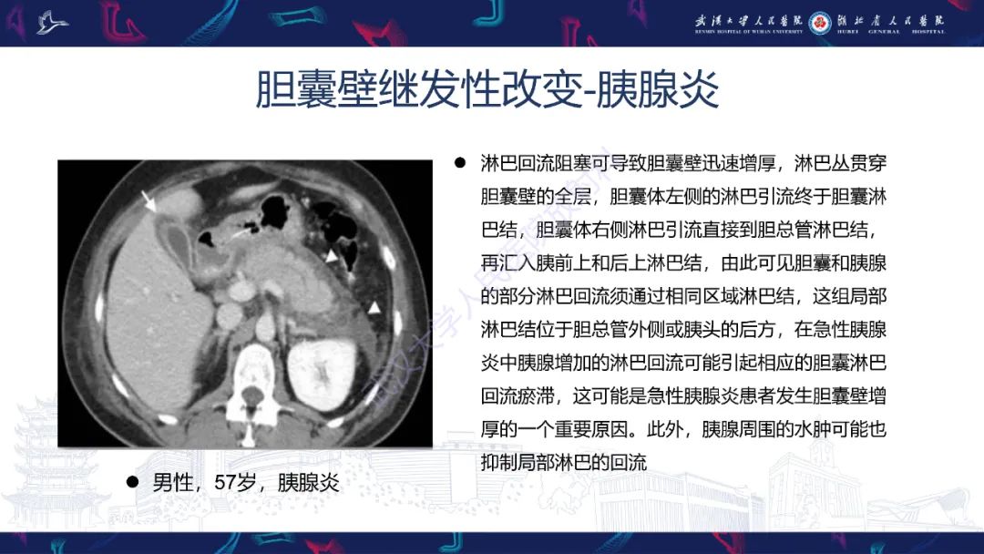 影像PPT - 【PPT】胆囊壁增厚影像鉴别诊断-27