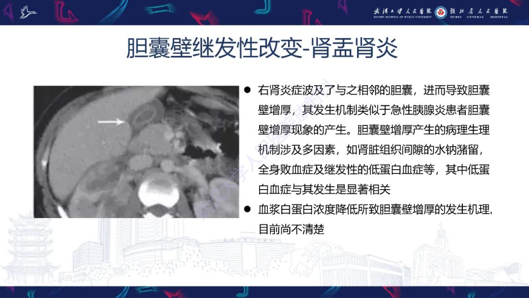 影像PPT - 【PPT】胆囊壁增厚影像鉴别诊断-28