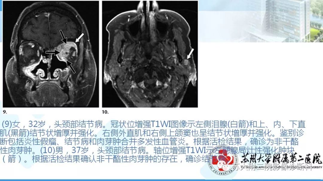 影像PPT - 【PPT】结节病-18