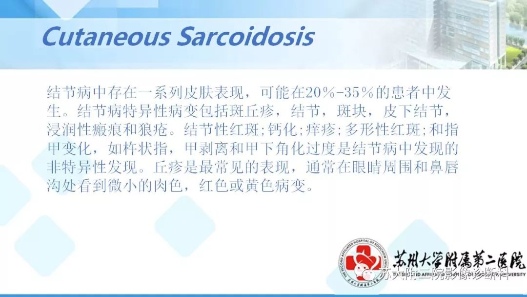 影像PPT - 【PPT】结节病-32