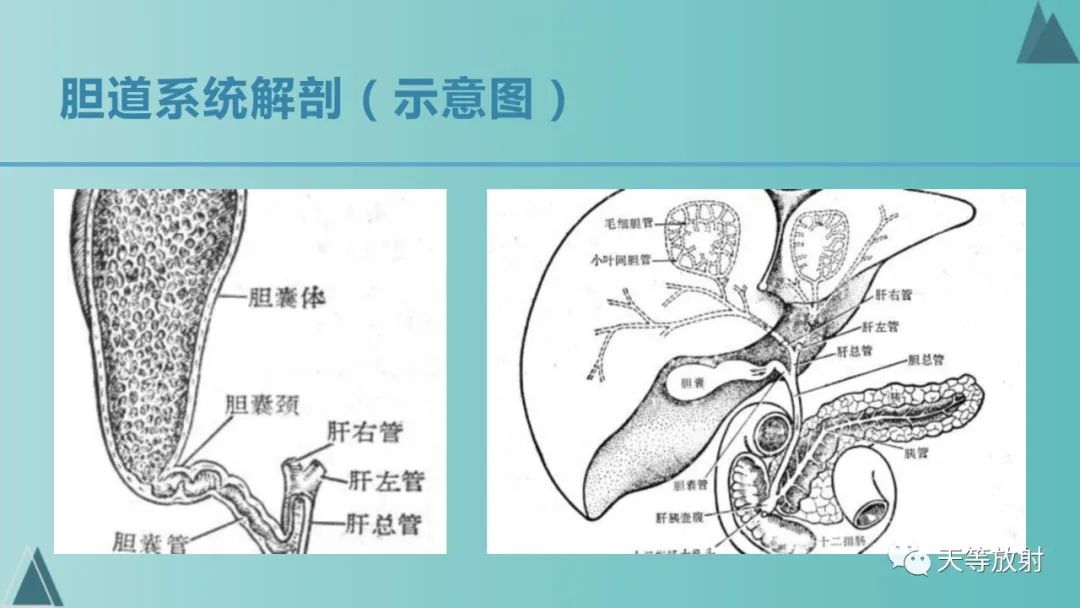 影像PPT - 【PPT】胆道梗阻的影像学诊断-2