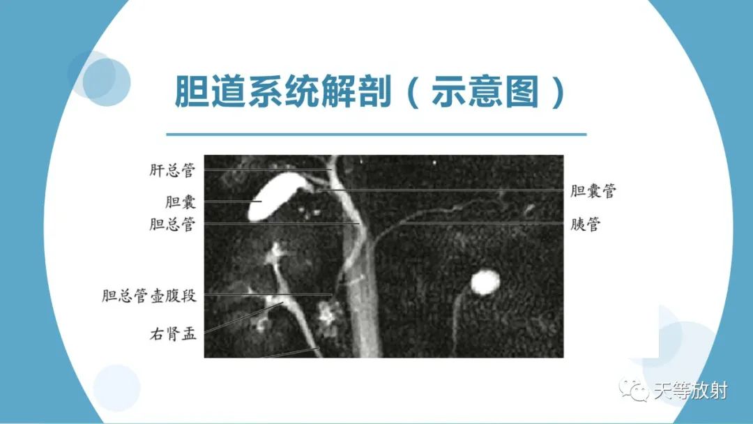 影像PPT - 【PPT】胆道梗阻的影像学诊断-3