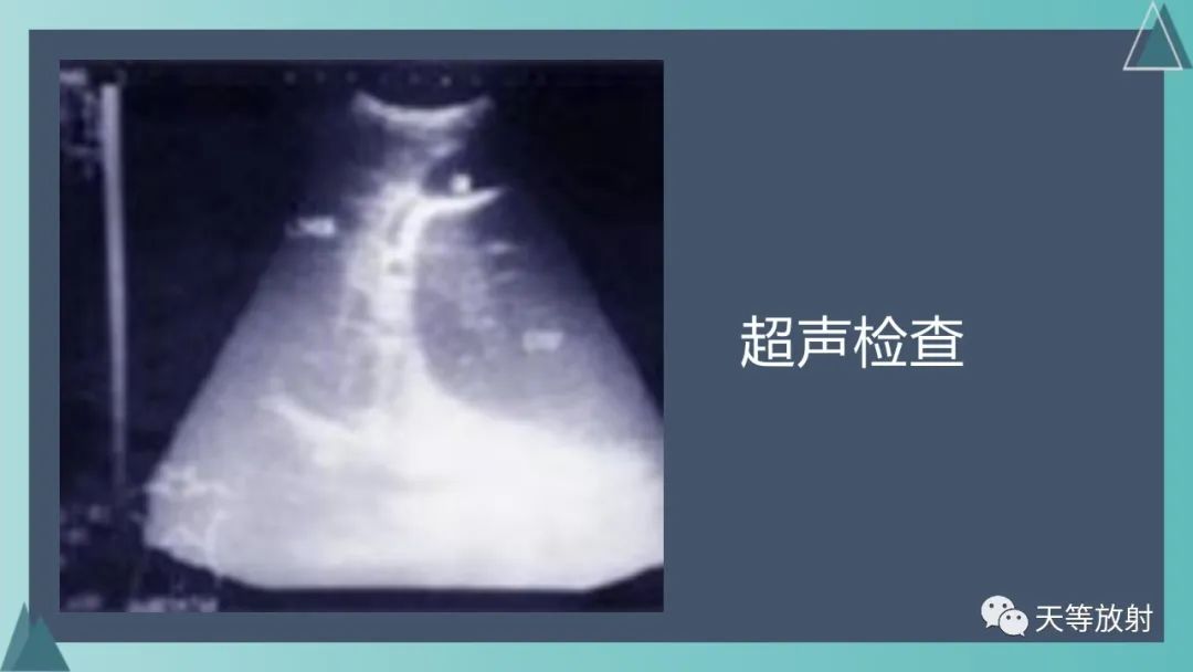 影像PPT - 【PPT】胆道梗阻的影像学诊断-8