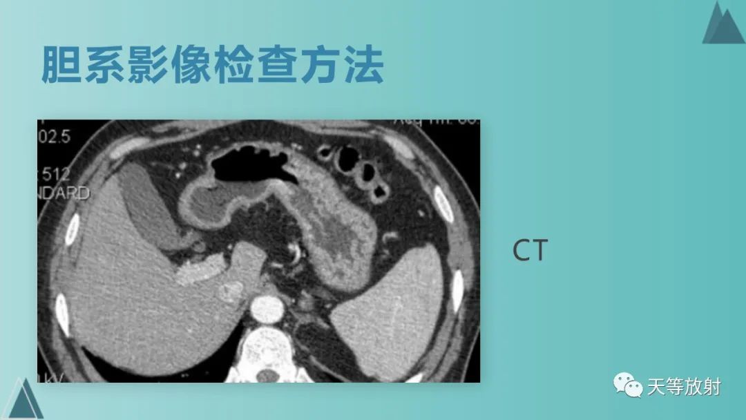 影像PPT - 【PPT】胆道梗阻的影像学诊断-13