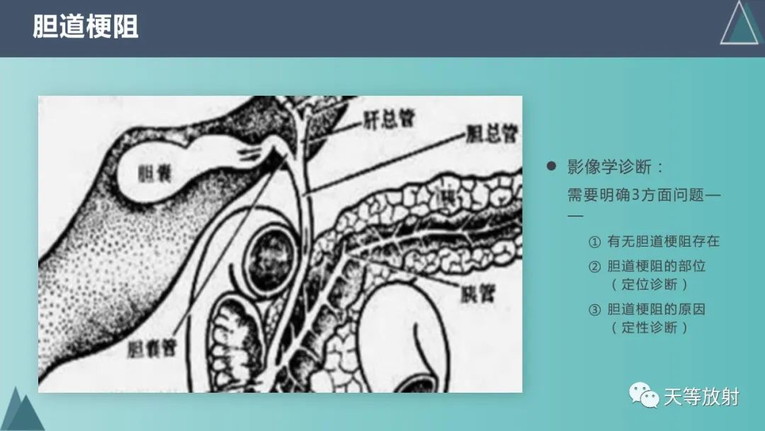 影像PPT - 【PPT】胆道梗阻的影像学诊断-22