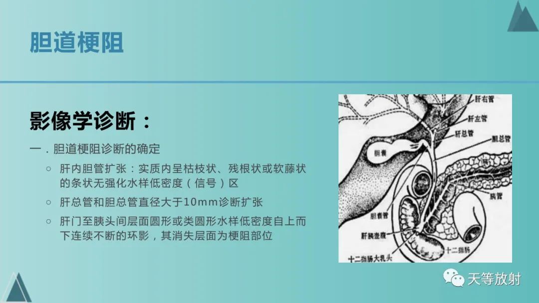 影像PPT - 【PPT】胆道梗阻的影像学诊断-23
