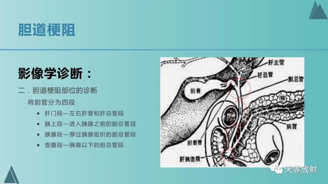 影像PPT - 【PPT】胆道梗阻的影像学诊断-25