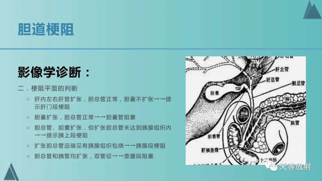 影像PPT - 【PPT】胆道梗阻的影像学诊断-26