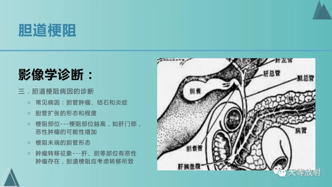 影像PPT - 【PPT】胆道梗阻的影像学诊断-27
