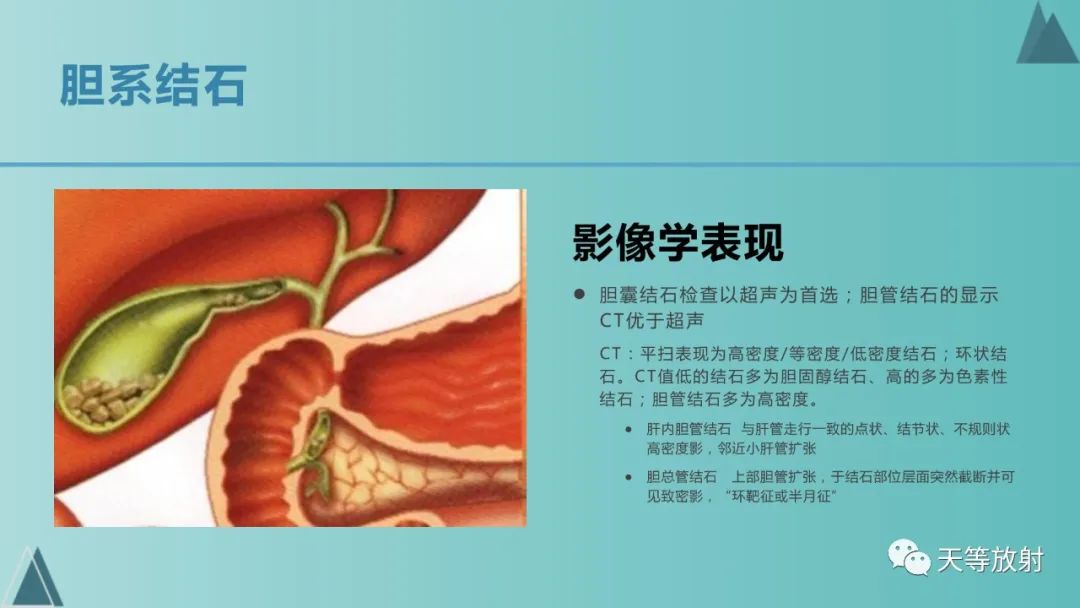 影像PPT - 【PPT】胆道梗阻的影像学诊断-31