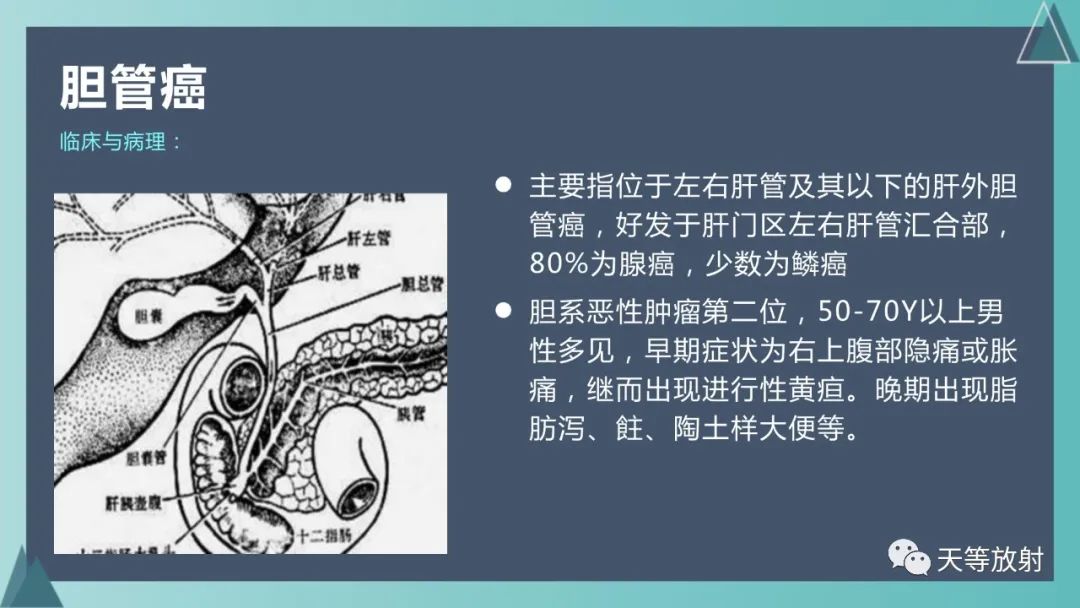 影像PPT - 【PPT】胆道梗阻的影像学诊断-48