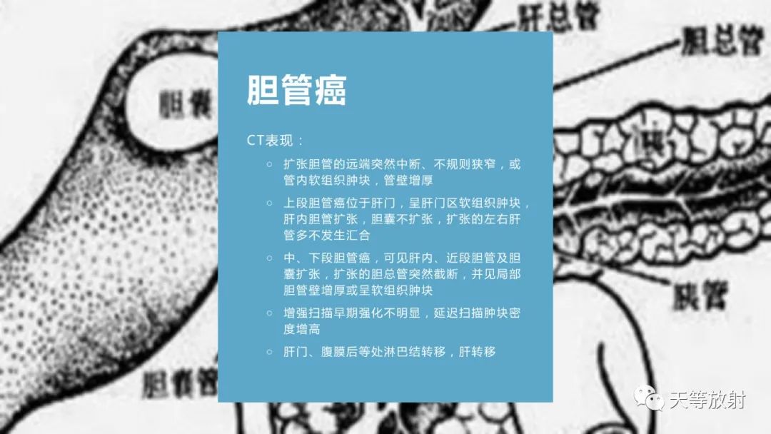 影像PPT - 【PPT】胆道梗阻的影像学诊断-50