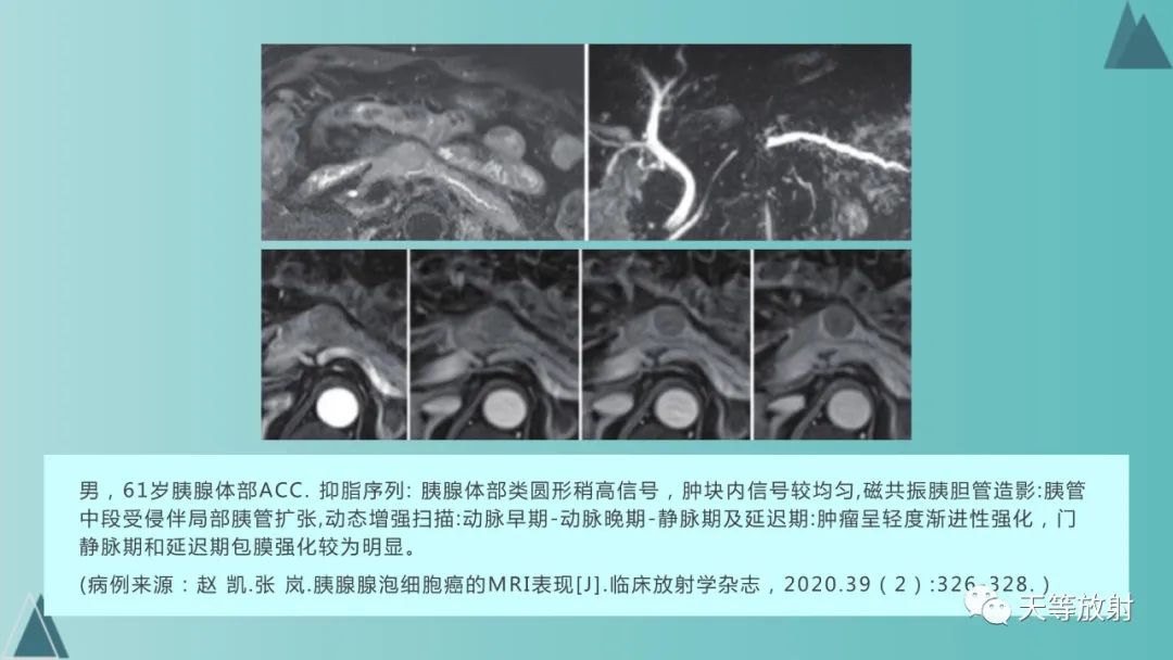 影像PPT - 【PPT】胆道梗阻的影像学诊断-69
