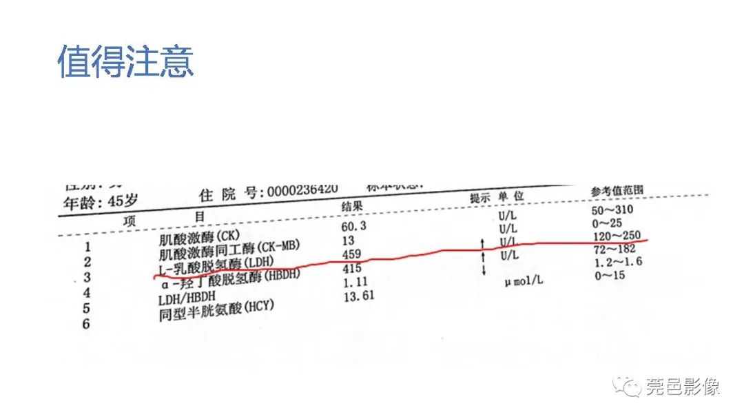 影像PPT - 【PPT】自发性肾动脉夹层CT诊断-8