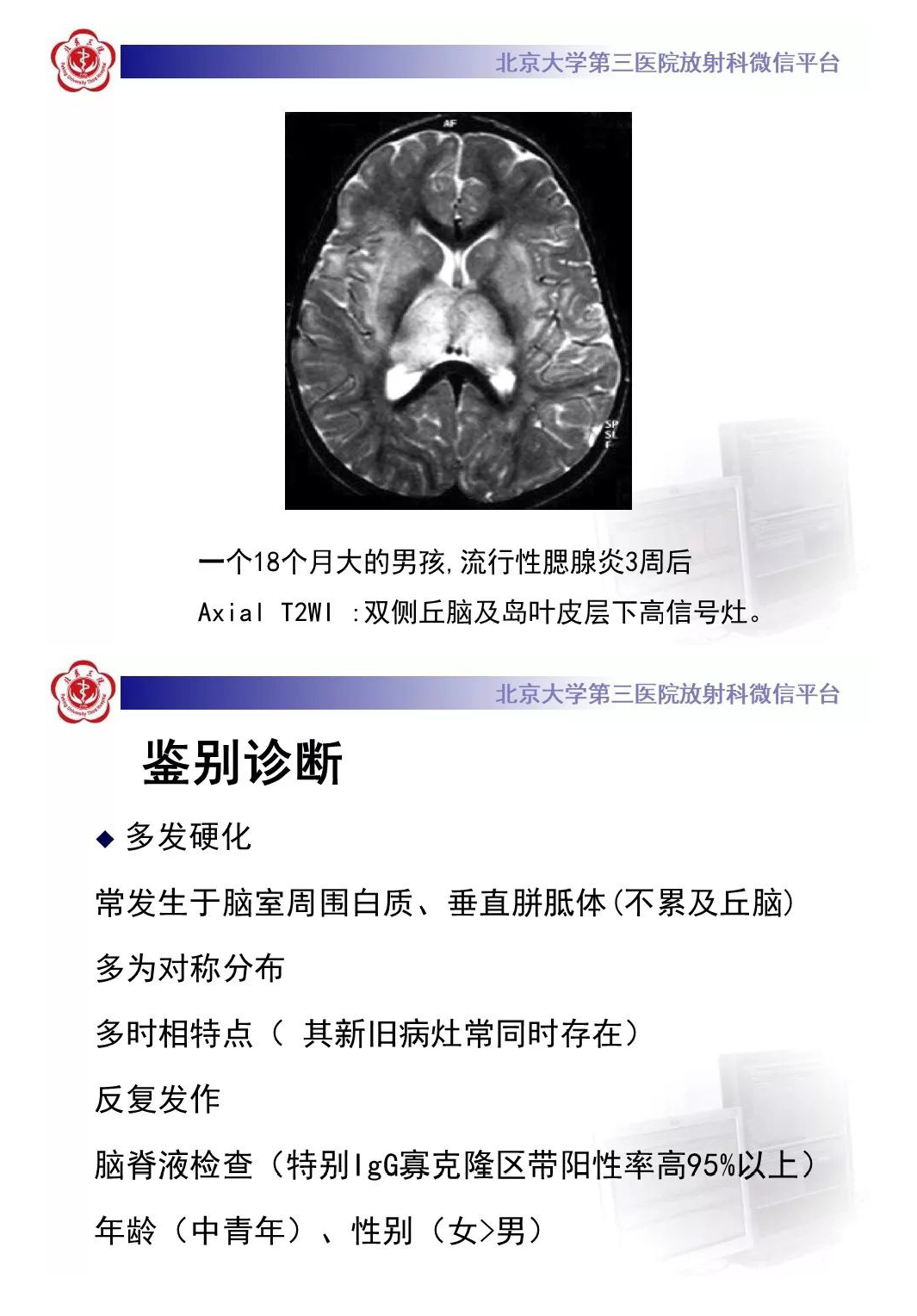 影像PPT - 【PPT】急性播散性脑脊髓炎-13