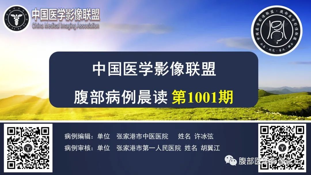 影像PPT - 【病例】肾球旁细胞瘤1例CT及MR影像诊断-1