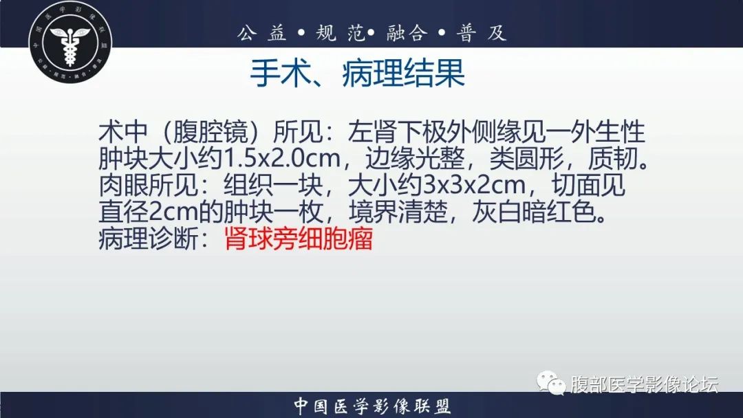 影像PPT - 【病例】肾球旁细胞瘤1例CT及MR影像诊断-19