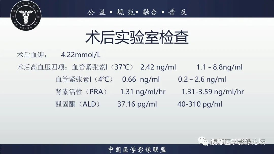 影像PPT - 【病例】肾球旁细胞瘤1例CT及MR影像诊断-20