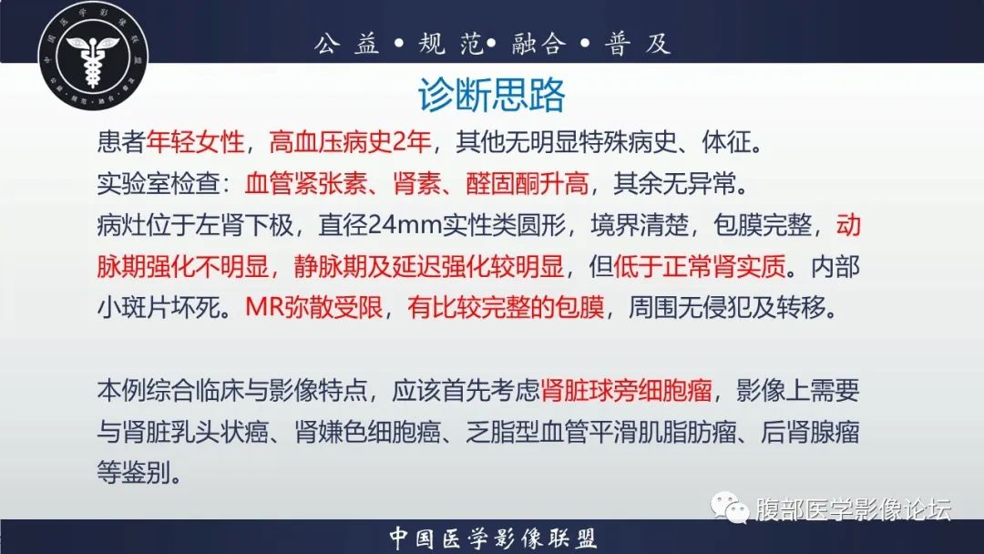 影像PPT - 【病例】肾球旁细胞瘤1例CT及MR影像诊断-22