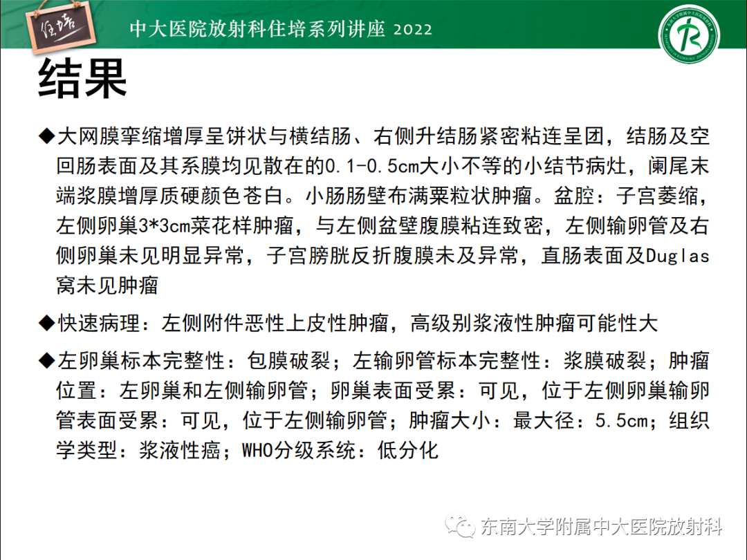 影像PPT - 【PPT】附件病变磁共振评分系统MRI O-RADS-44