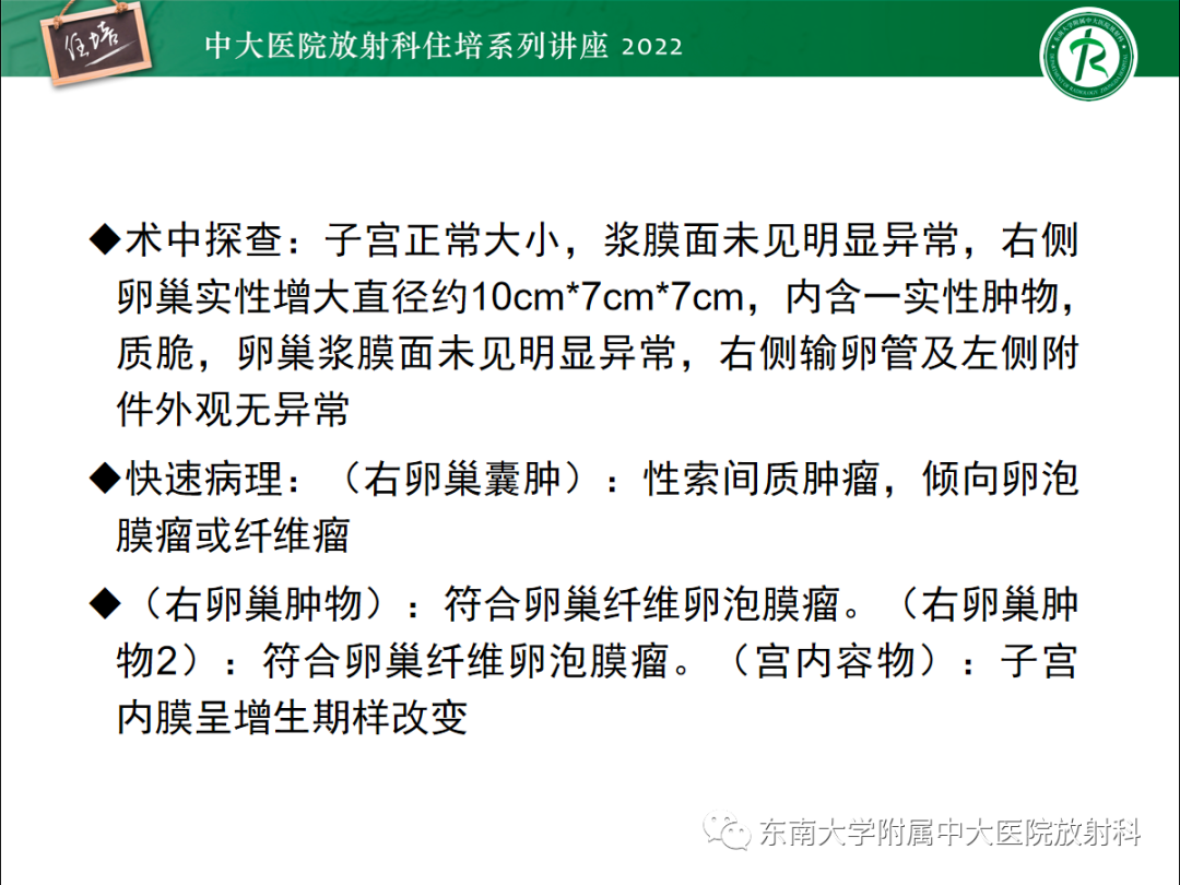 影像PPT - 【PPT】附件病变磁共振评分系统MRI O-RADS-48