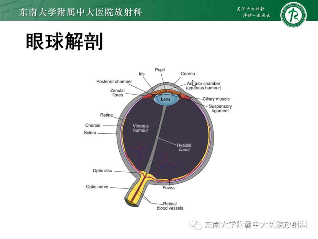 影像PPT - 【PPT】脉络膜黑色素瘤-4