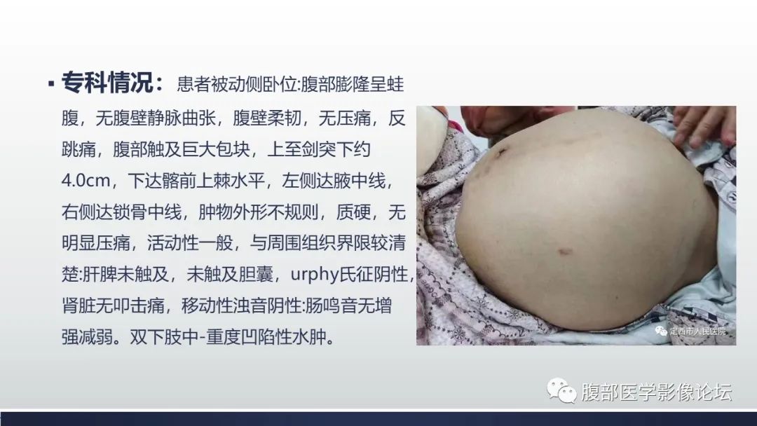 影像PPT - 【病例】腹腔恶性孤立性纤维性肿瘤1例CT影像-3