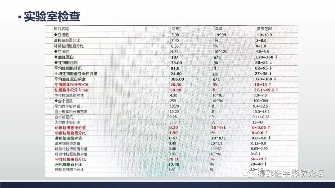 影像PPT - 【病例】腹腔恶性孤立性纤维性肿瘤1例CT影像-4
