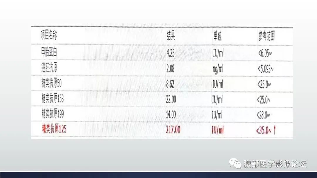 影像PPT - 【病例】腹腔恶性孤立性纤维性肿瘤1例CT影像-5