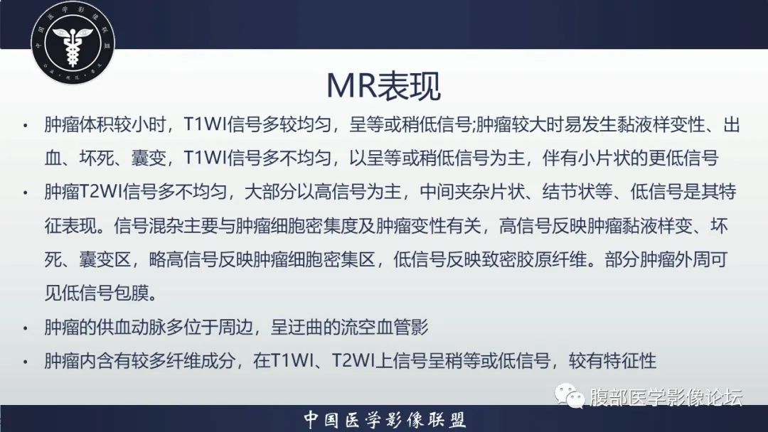 影像PPT - 【病例】腹腔恶性孤立性纤维性肿瘤1例CT影像-34