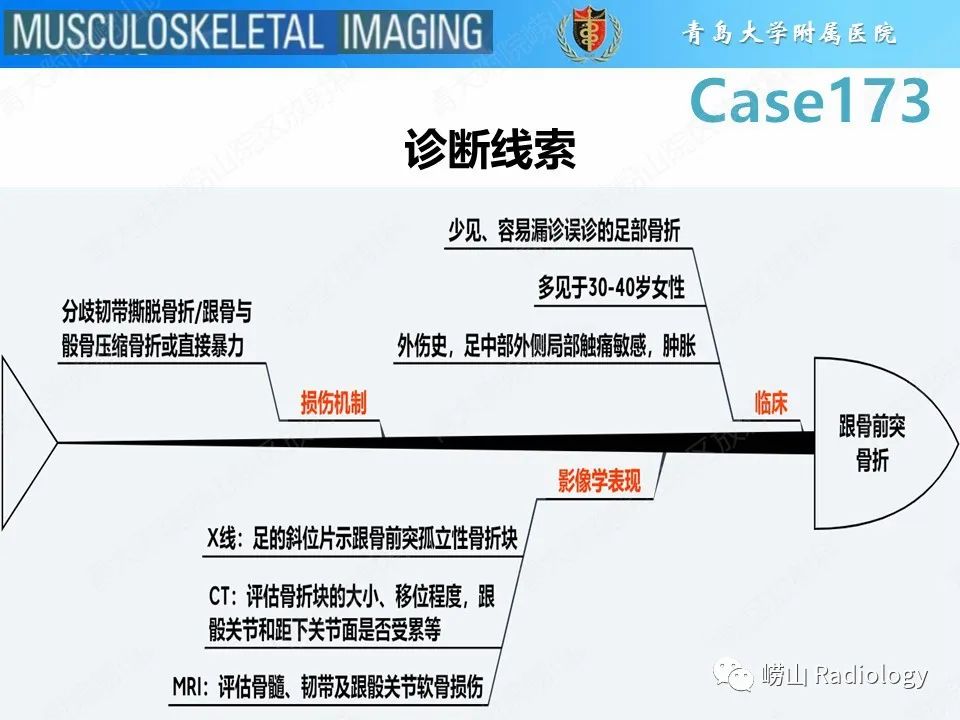 影像PPT - 【PPT】跟骨前突骨折-25