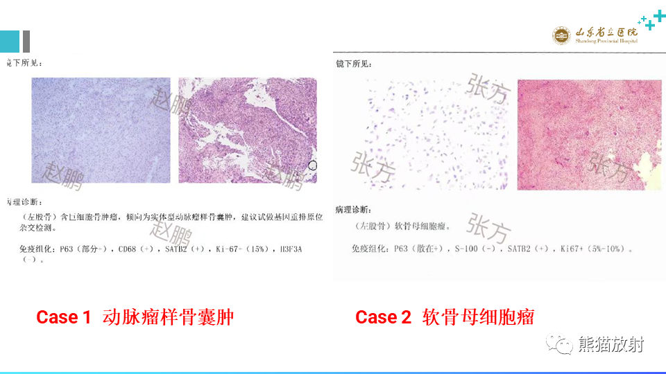 影像PPT - 【病例】股骨远端动脉瘤样骨囊肿ABC VS 软骨母细胞瘤-10